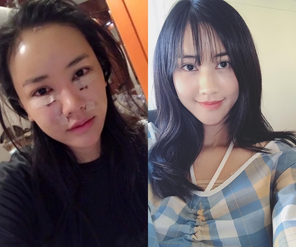 6 sao Việt công khai thừa nhận phẫu thuật thẩm mỹ trong năm 2017